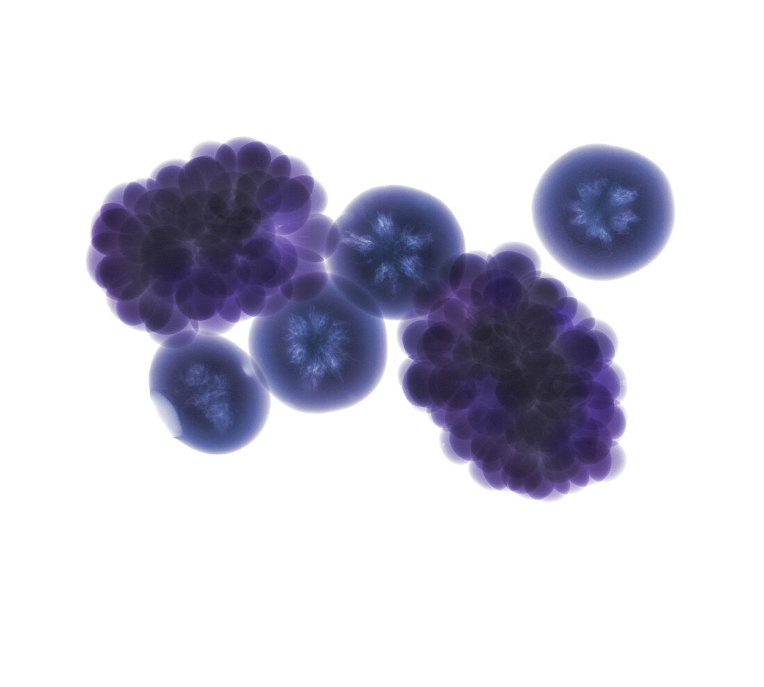 Blackberries and blueberries, X-ray
