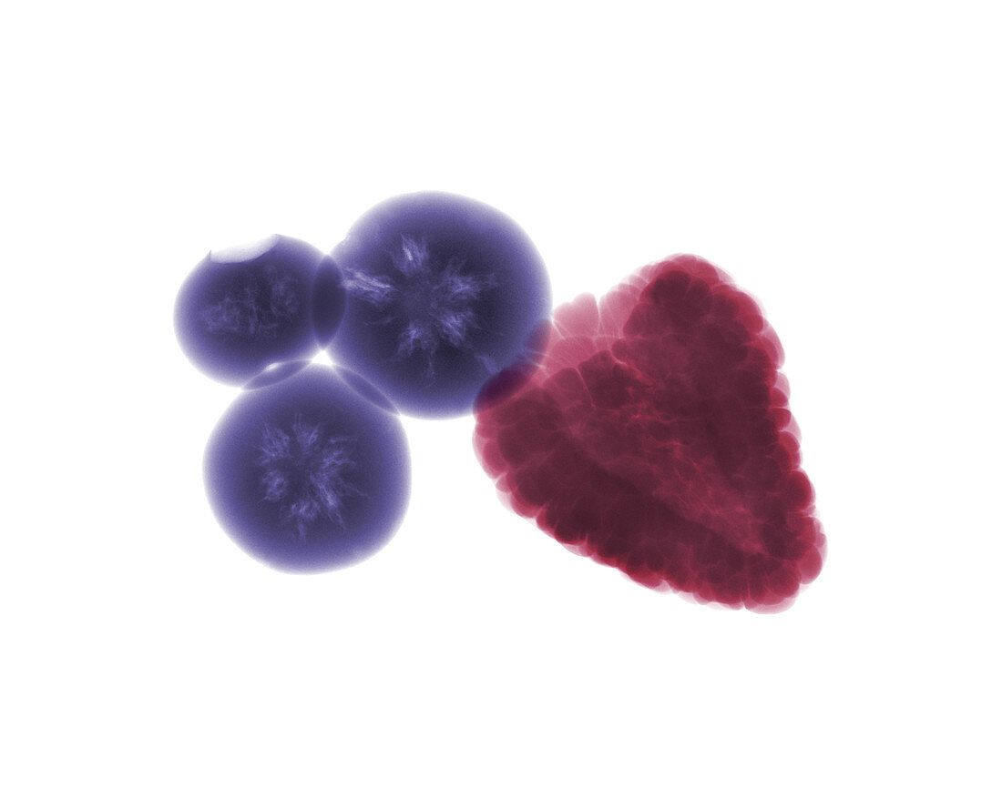 Raspberry and blueberries, X-ray