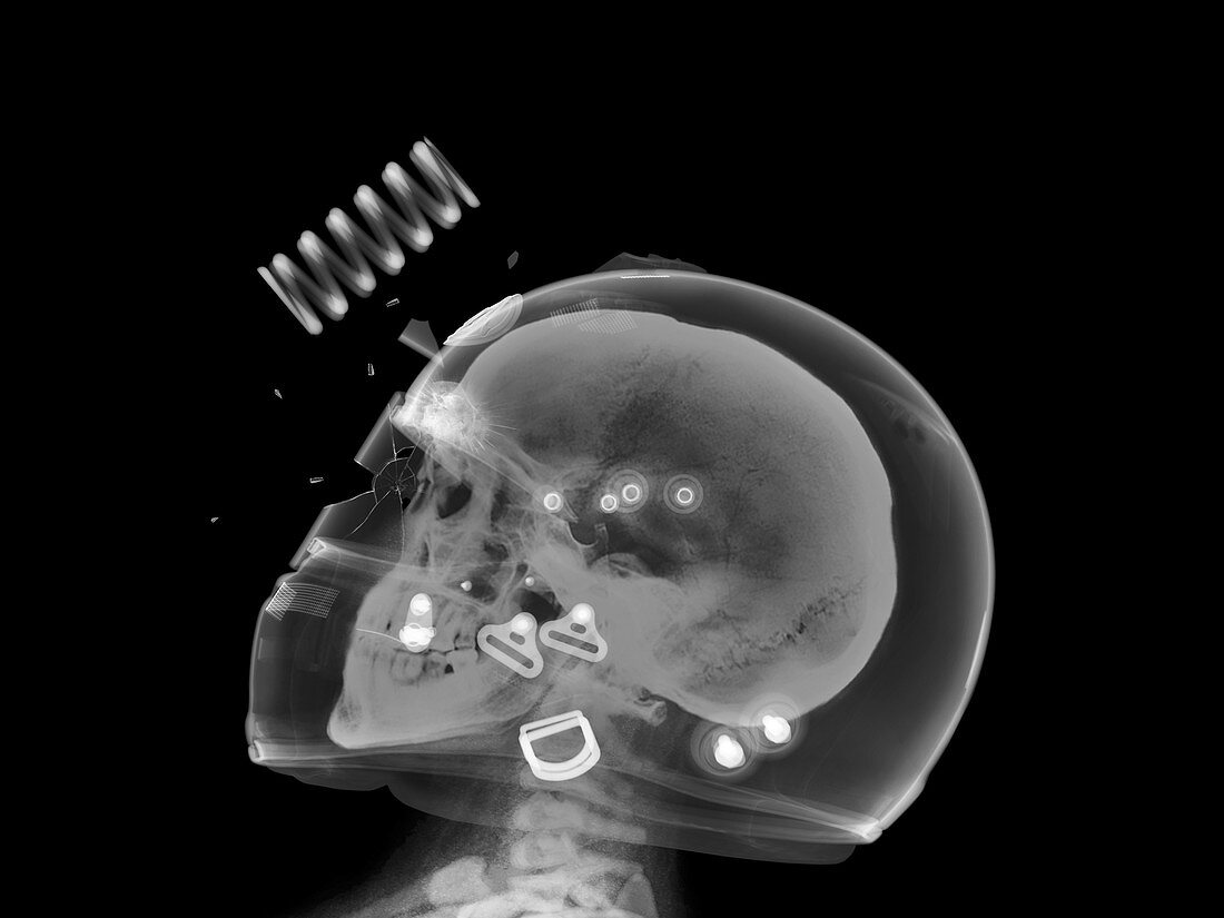 Skull and damaged helmet and visor, X-ray