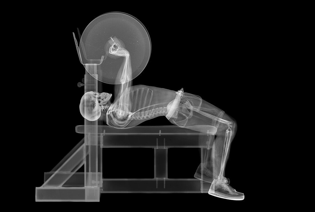 Weightlifter skeleton bench press, X-ray
