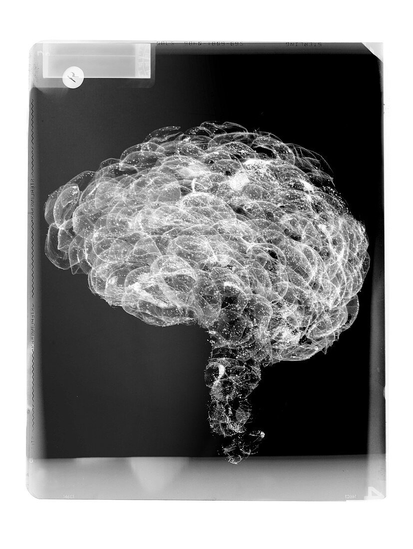 Mammal brain on film, X-ray