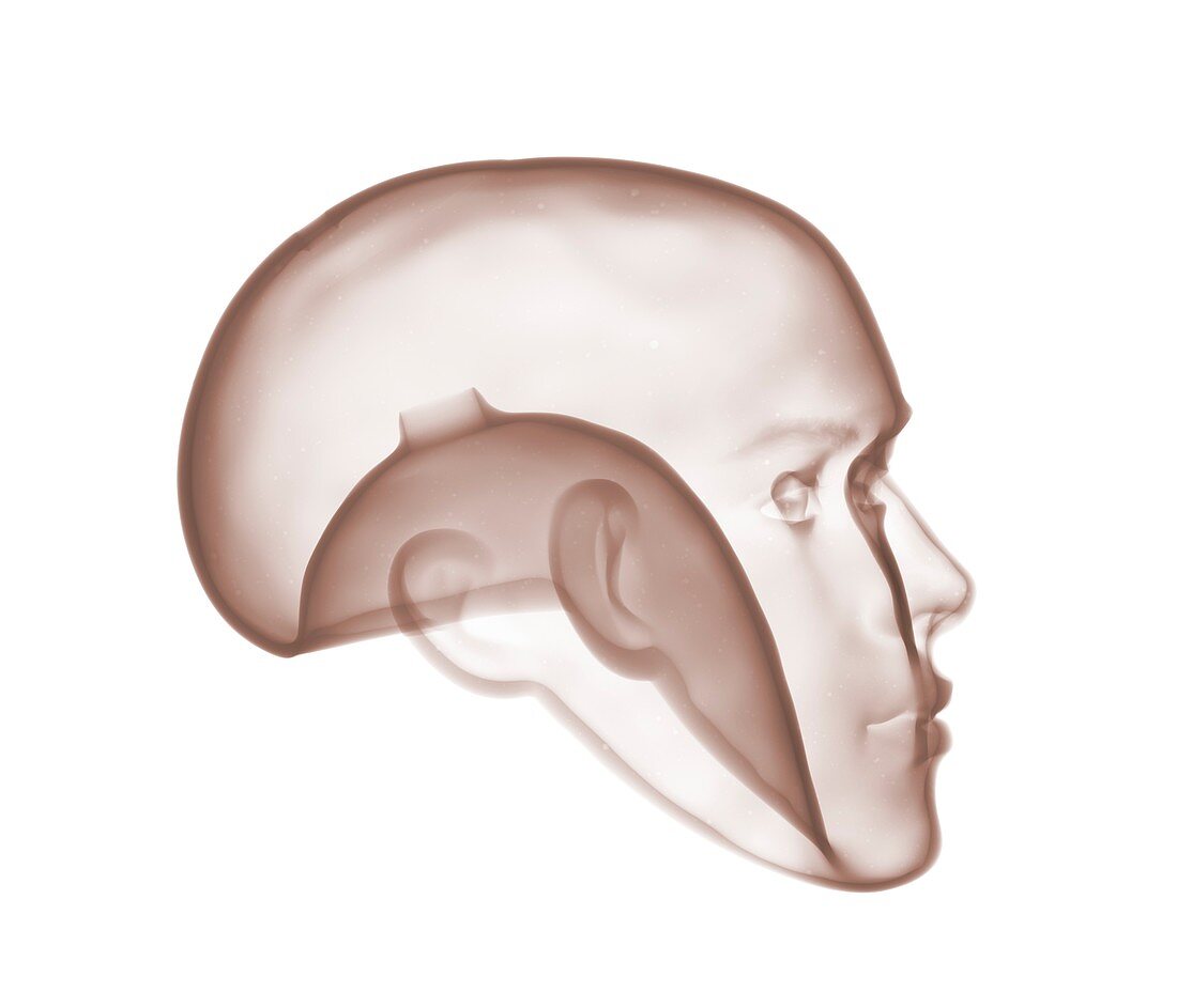 Mannequin head, X-ray