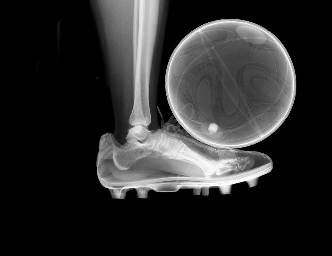 Foot kicking a football, X-ray