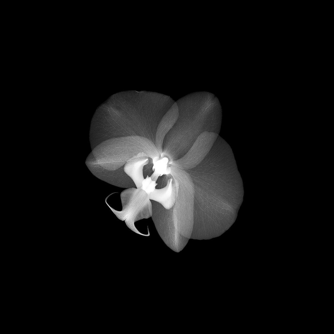 Orchid (Phalaenopsis sp.), X-ray