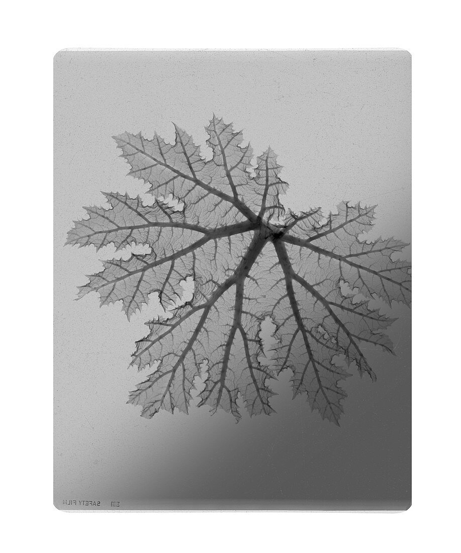 Rhubarb Leaf X Ray Bild Kaufen 13274403 Science Photo Library