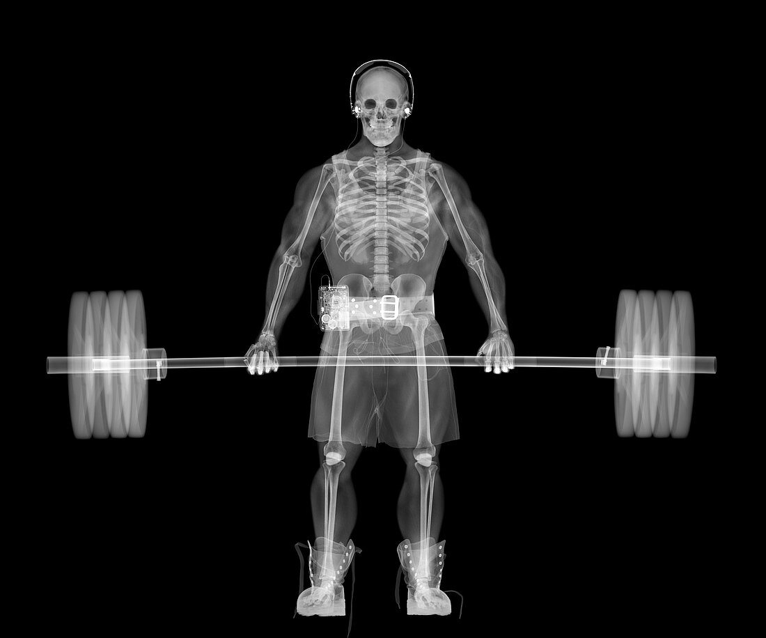 Skeleton weightlifter, X-ray