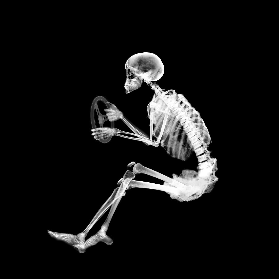 Skeleton in driving position, X-ray