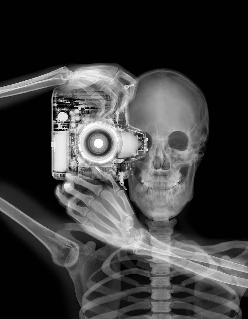 Skeleton and camera, X-ray