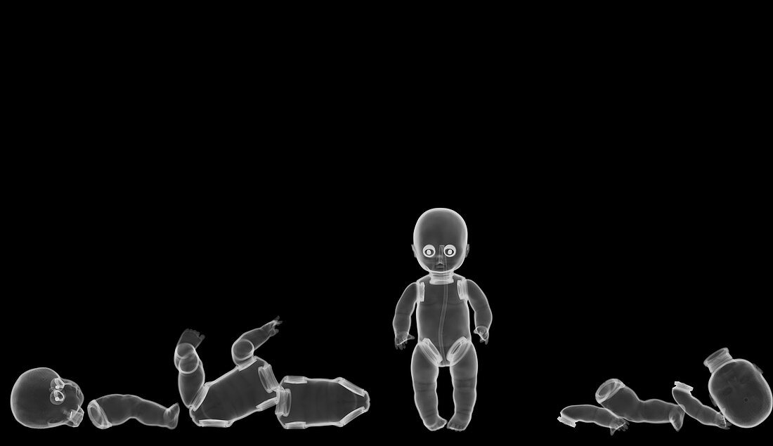 Plastic baby doll toys, X-ray