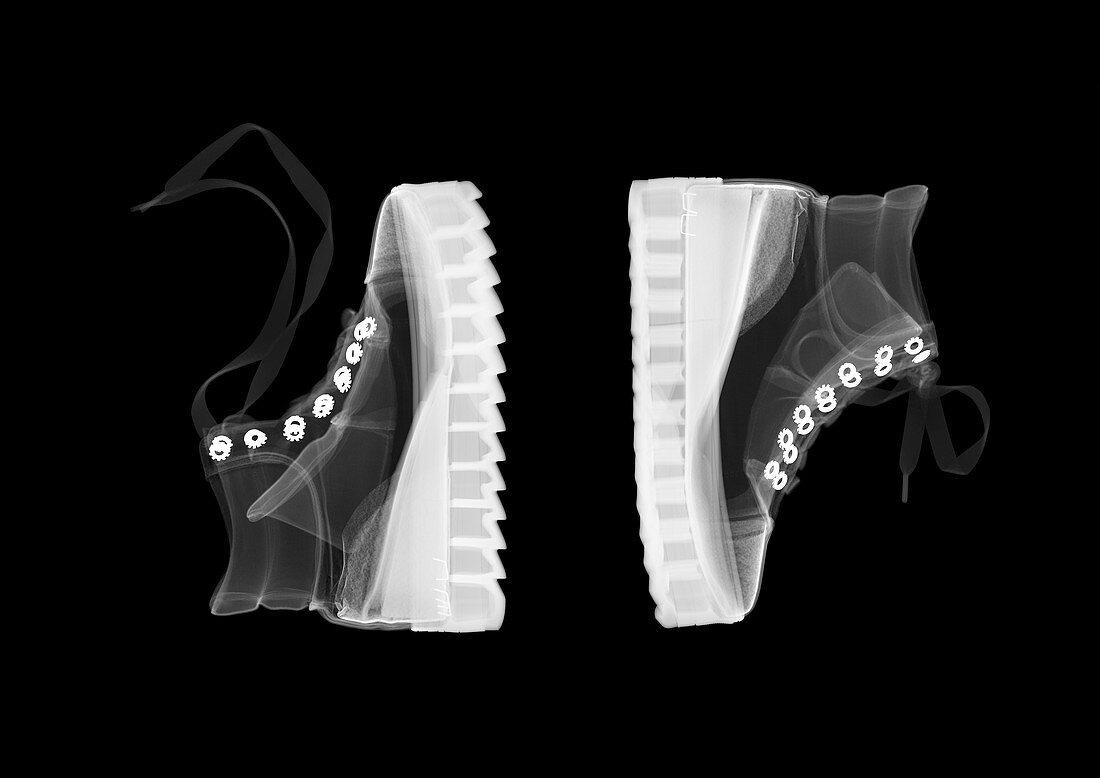 Wedge ankle boots, X-ray