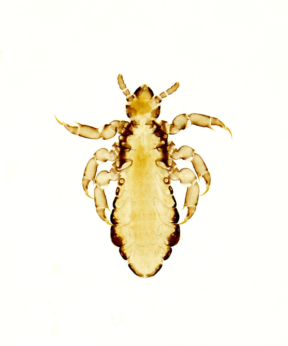 Human louse, light micrograph