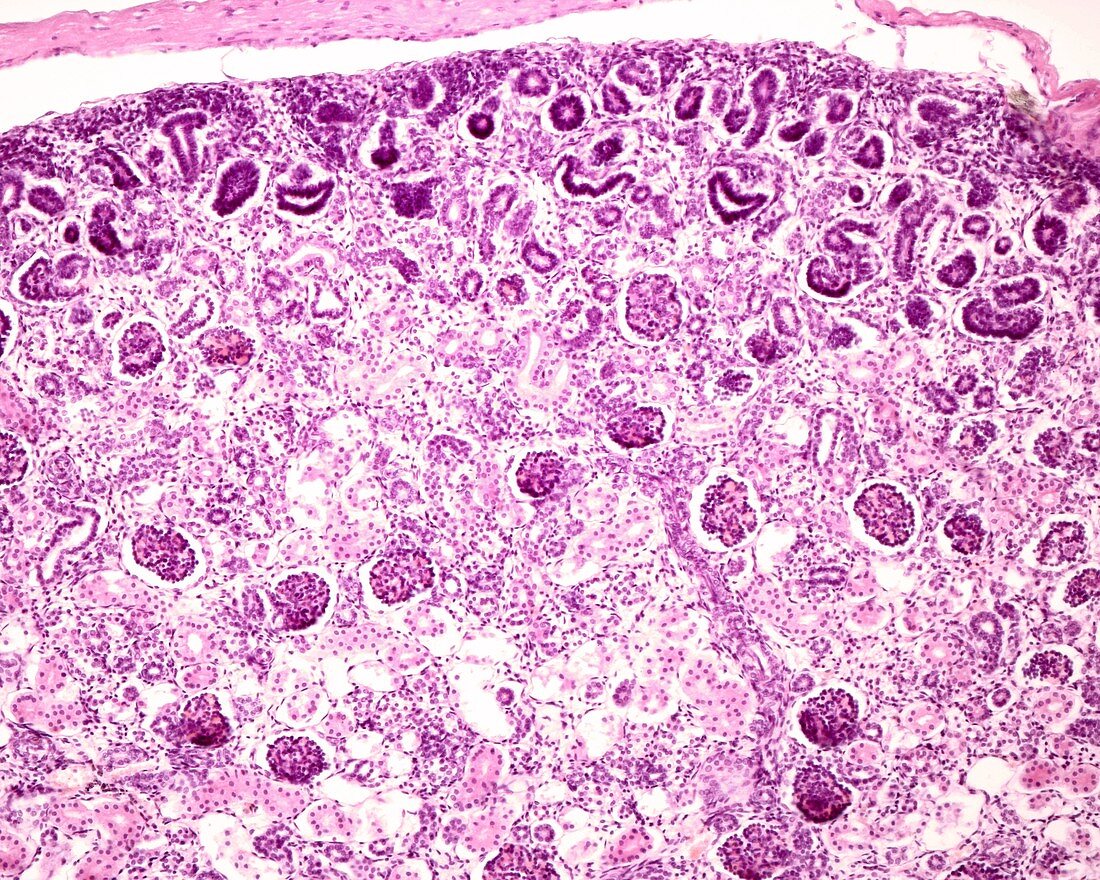 Foetal kidney, light micrograph