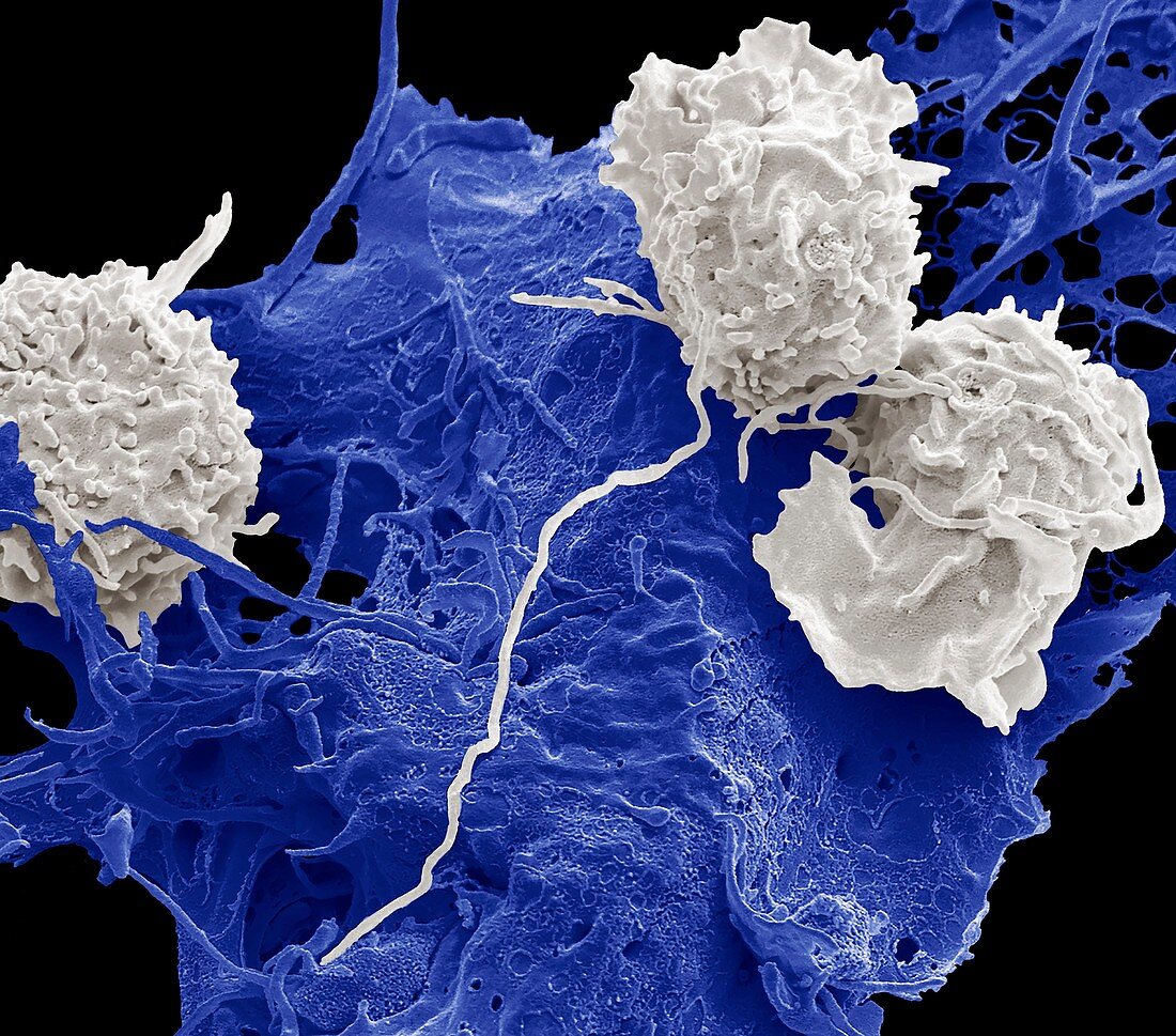 Natural killercells and cancer cell, SEM