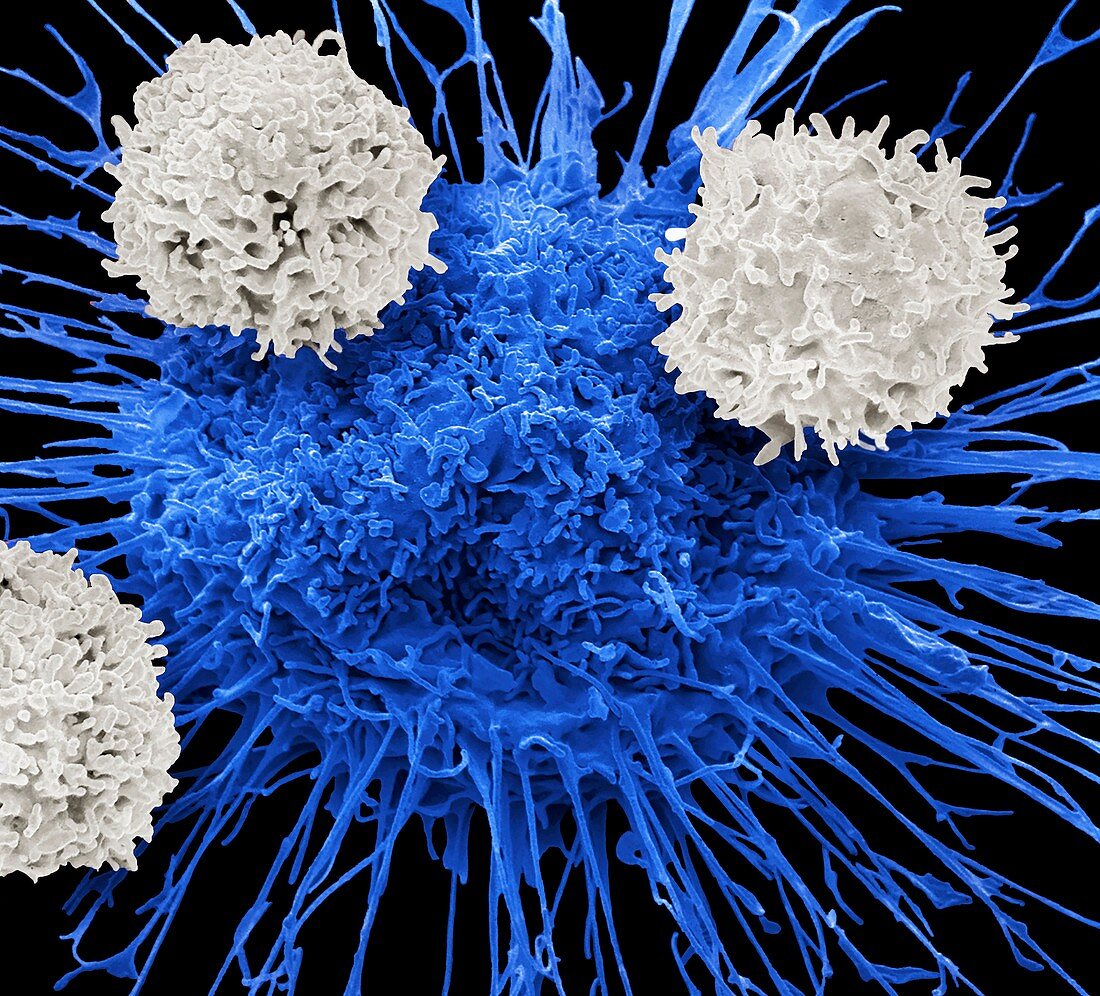 T-cells and lung cancer cell, SEM
