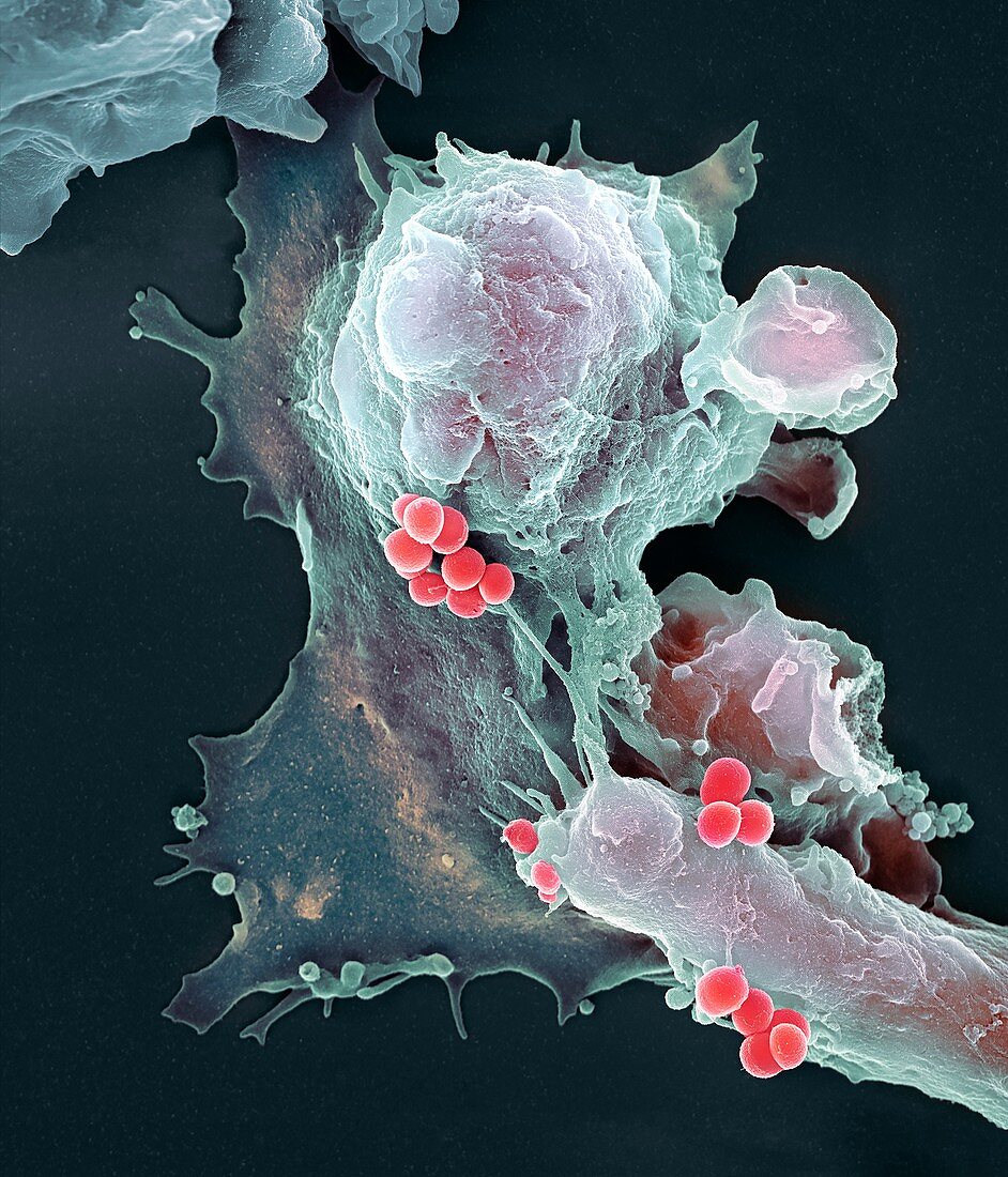 Neutrophil engulfing Staphylococcus aureus bacteria, SEM