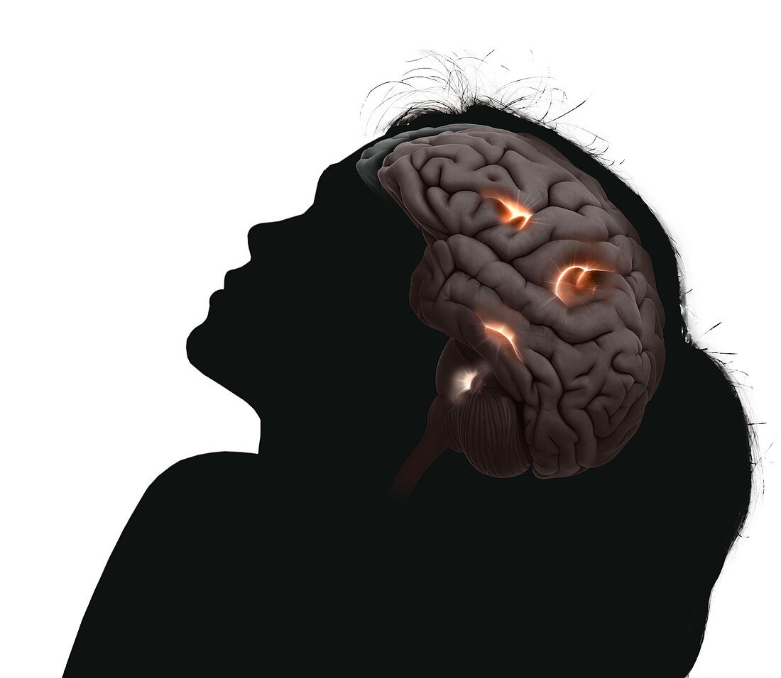 Brain activity during sex, conceptual illustration