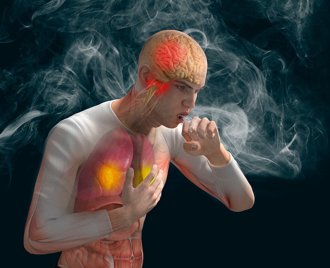 Lung irritant, illustration