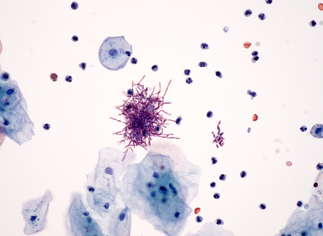 Yeast in urine, light micrograph