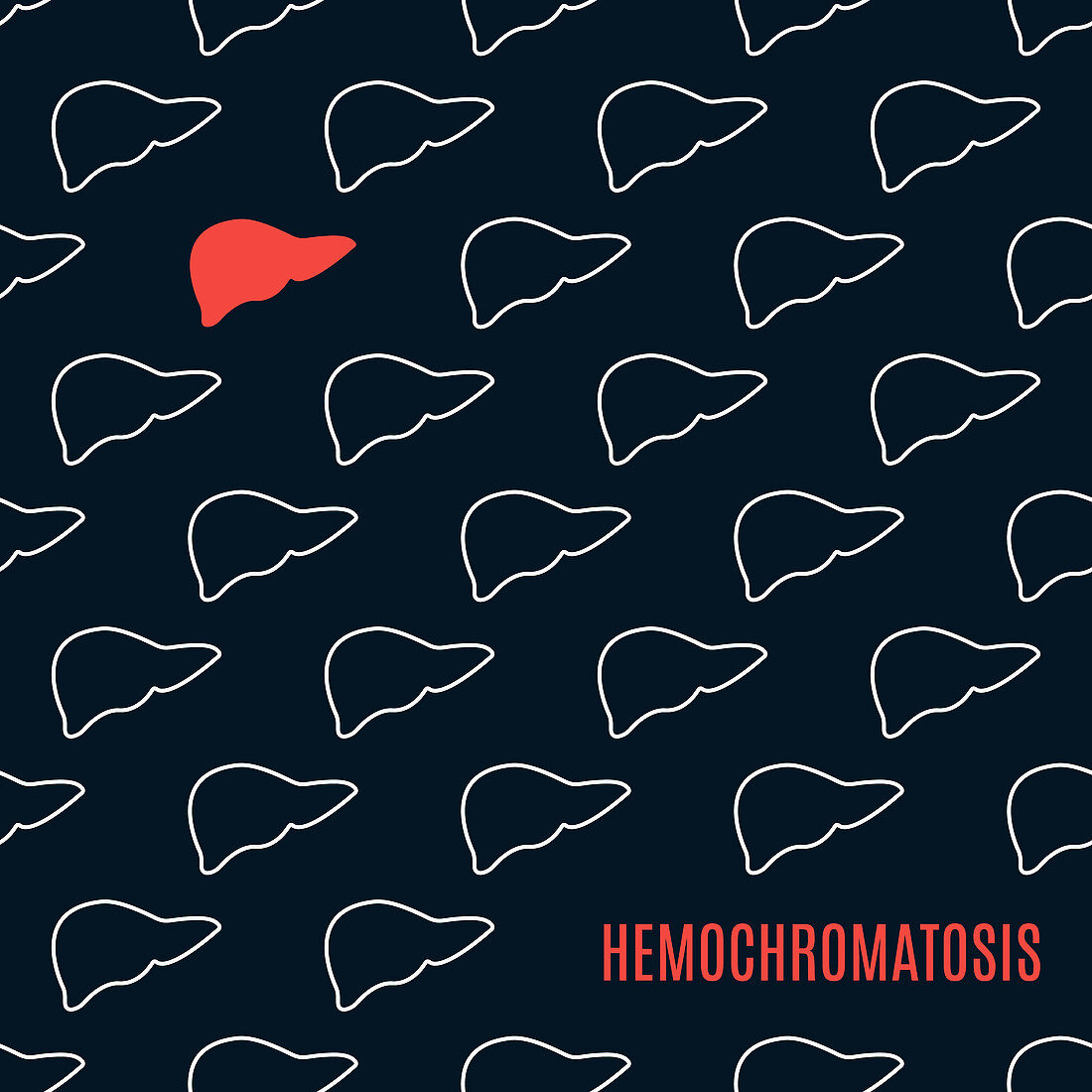 Hemochromatosis, illustration