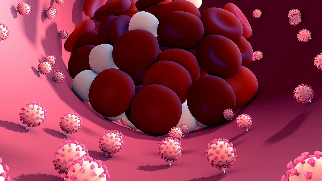 Coronavirus infection, conceptual illustration