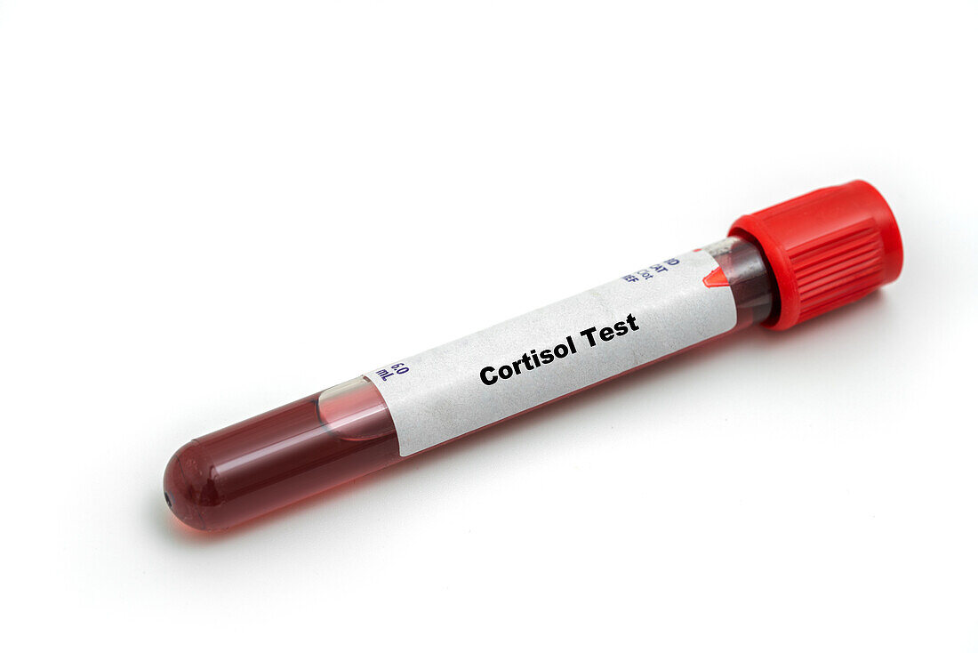 Cortisol test, conceptual image