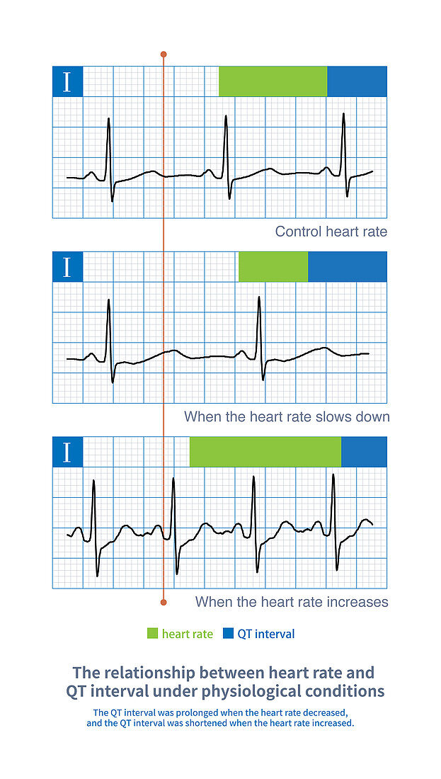 Heart rate and QT interval, illustration