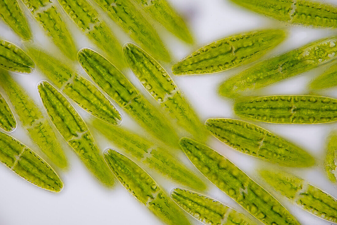 Netrium digitus algae, light micrograph