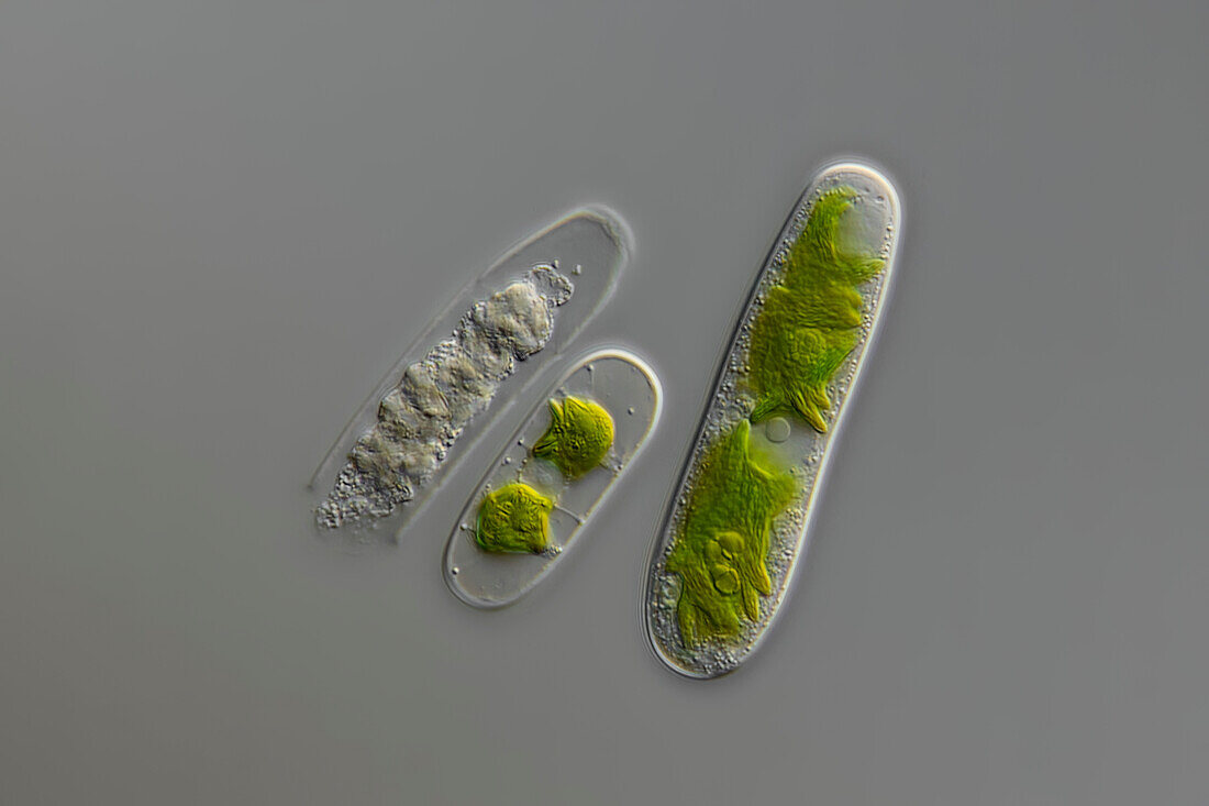 Cylindrocystis brebissonii algae, light micrograph
