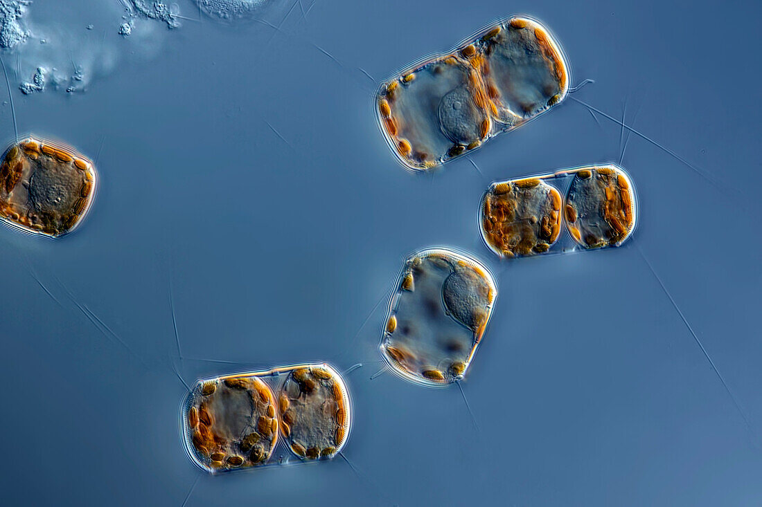 Thalassiosira punctigera, light micrograph