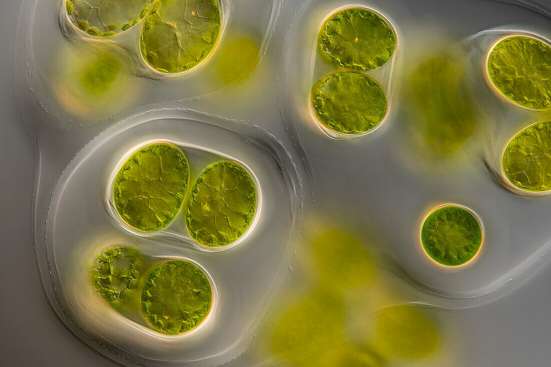 Neglectella eremosphaerophila, algae, light micrograph