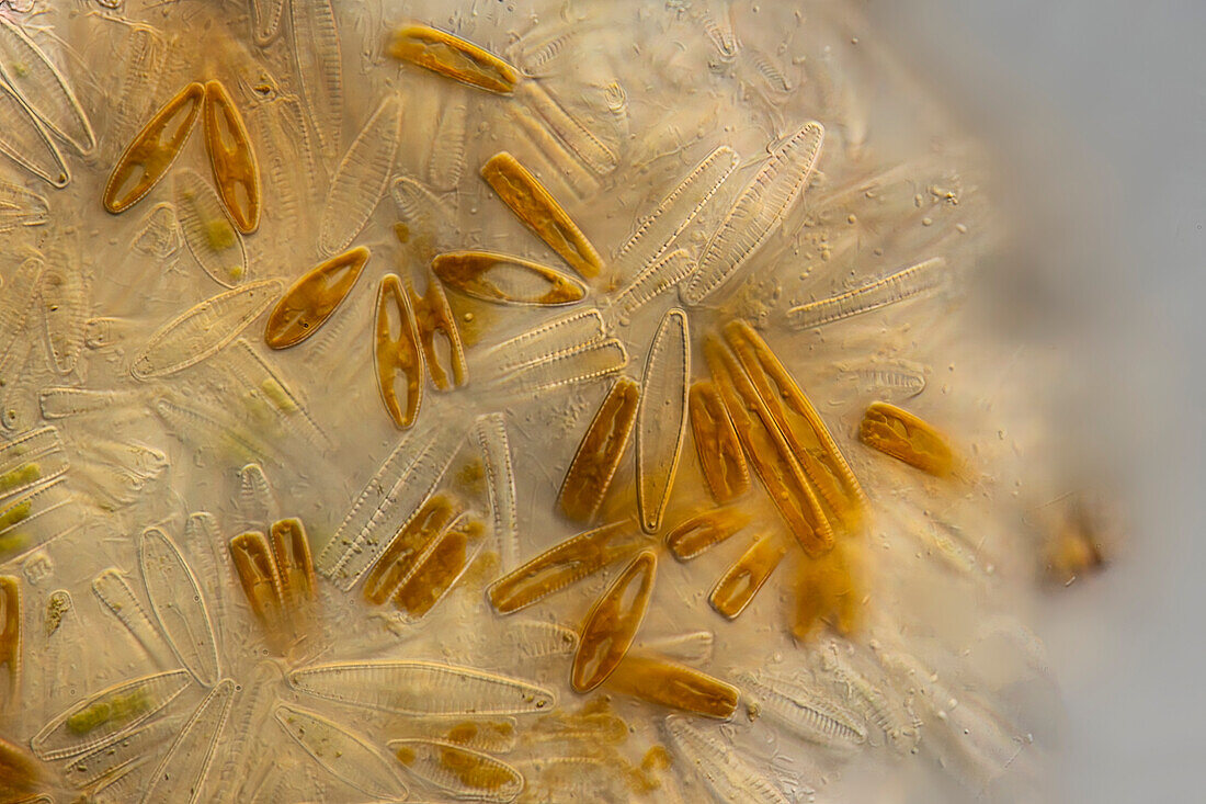 Rhoicosphenia sp. algae, light micrograph
