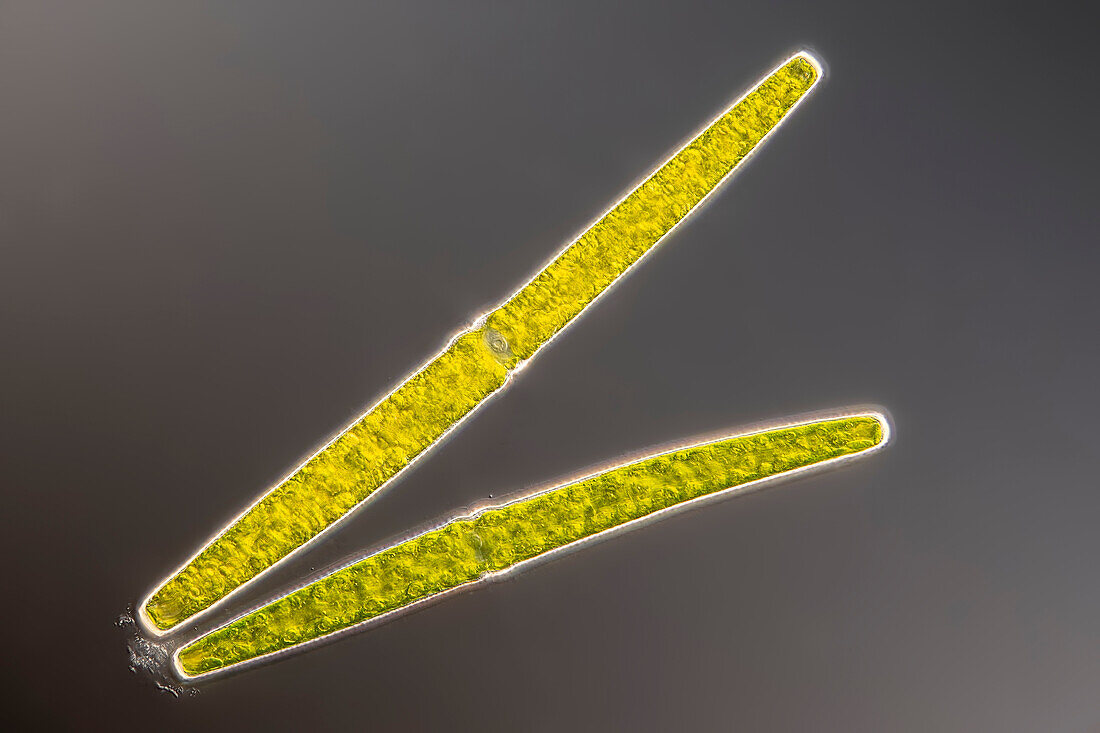 Pleurotaenium trabecula algae, light micrograph