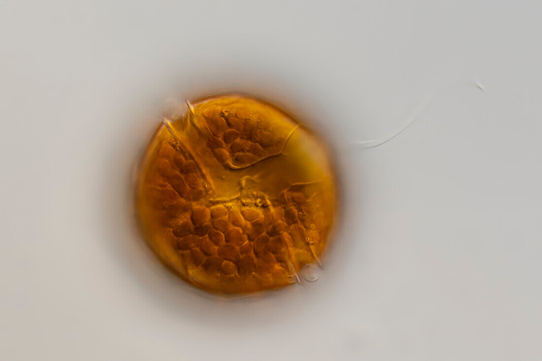 Peridinium cinctum algae, light micrograph
