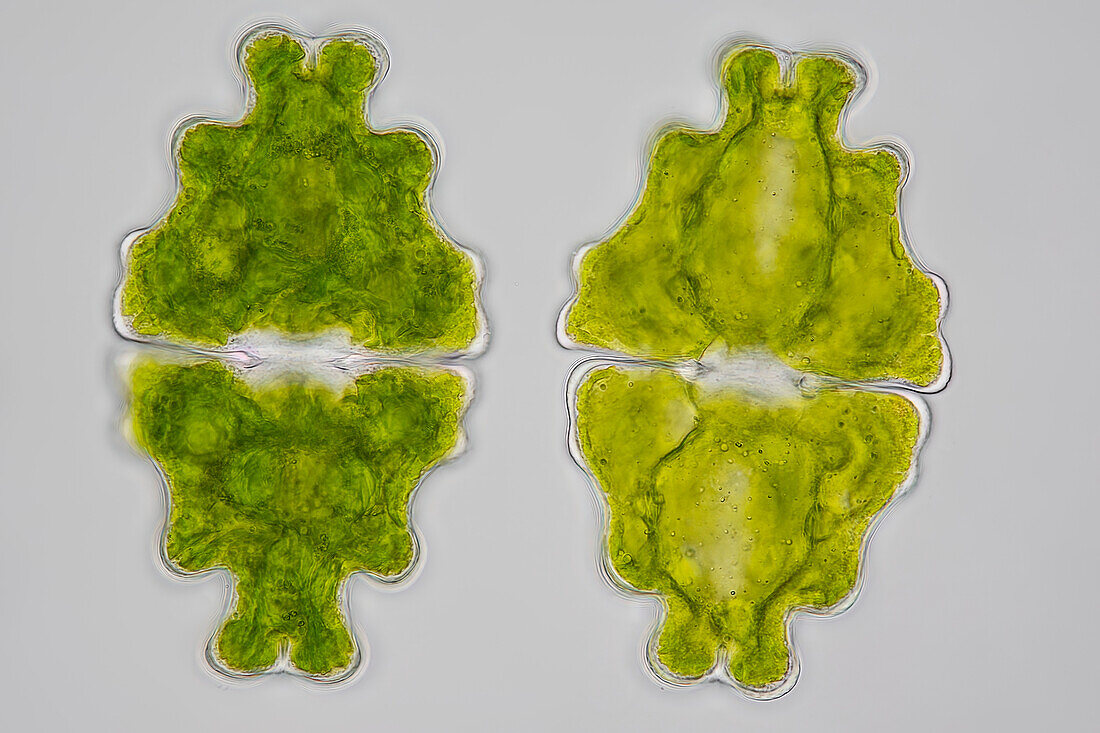 Euastrum humerosum desmid algae, light micrograph