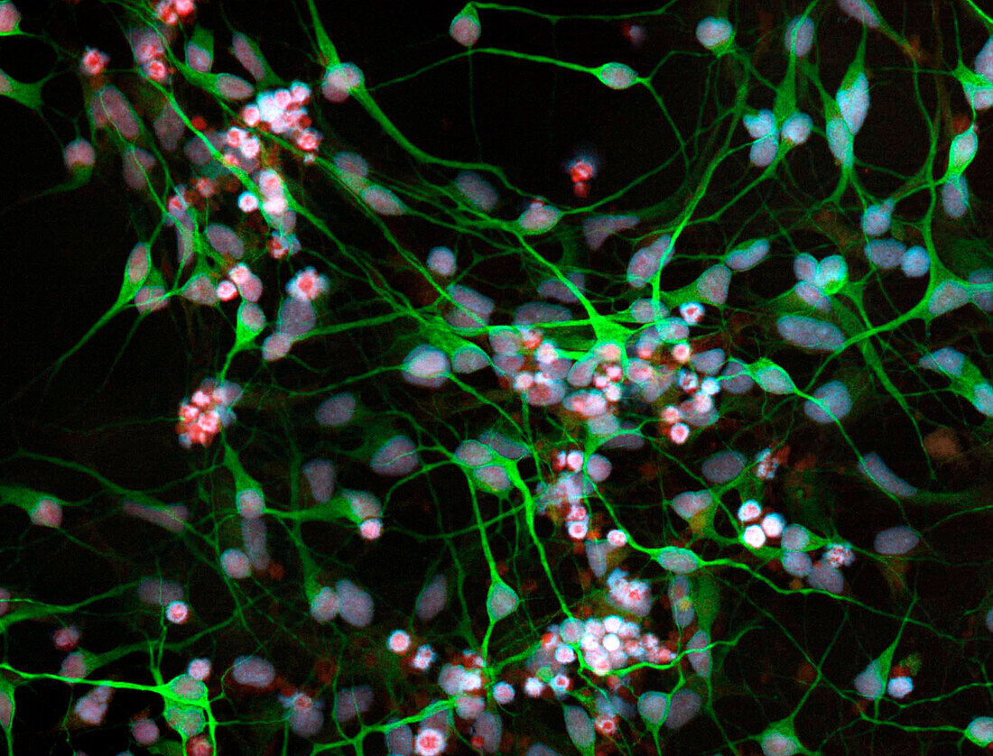 Stem cell-derived neurons, light micrograph