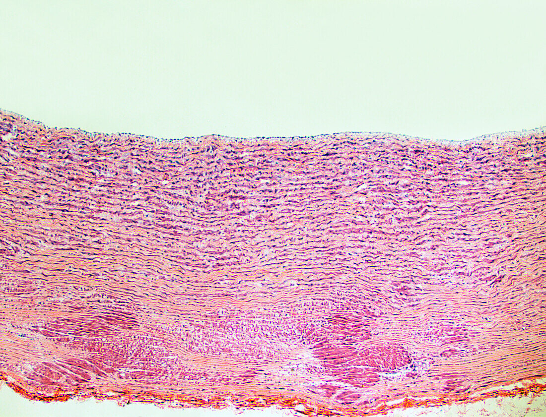 Artery wall, light micrograph