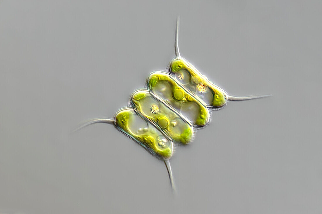 Scenedesmus quadricauda cf. algae, light micrograph
