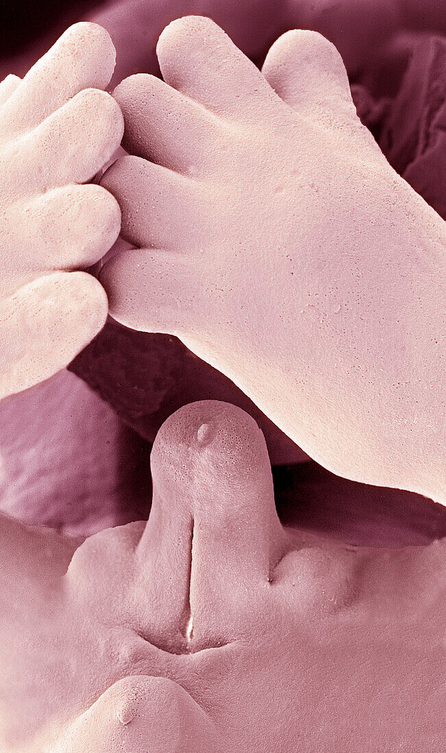 Human foetal genitalia, SEM