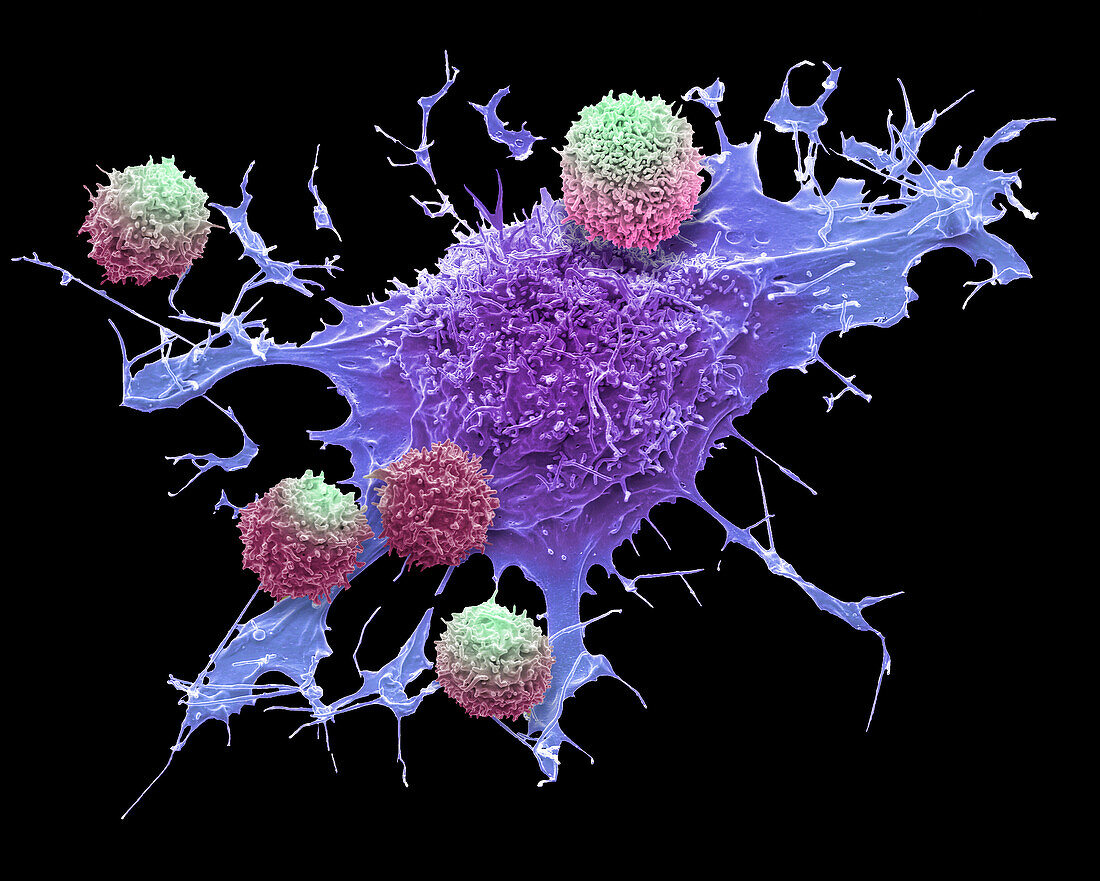 CAR T-cell therapy, SEM