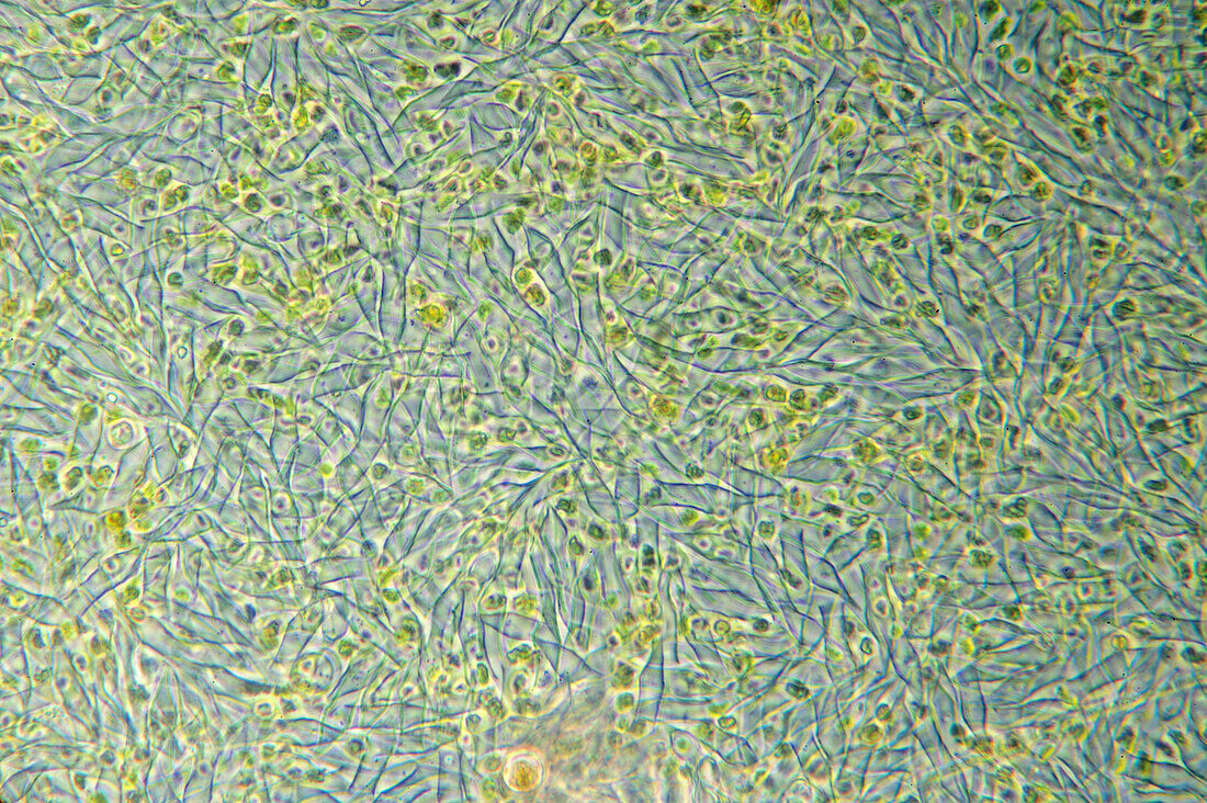 Algae from freshwater pond, light micrograph
