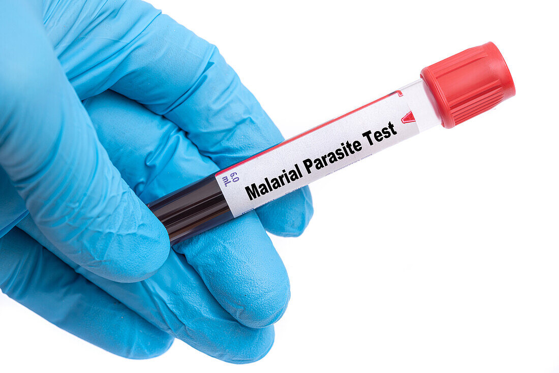 Malarial parasite test, conceptual image