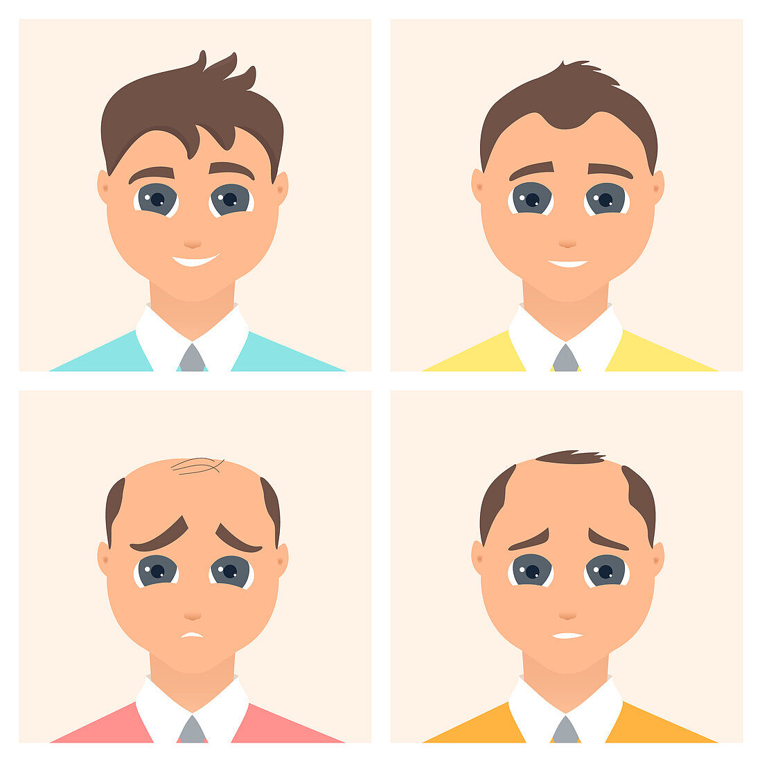 Male alopecia stages, illustration