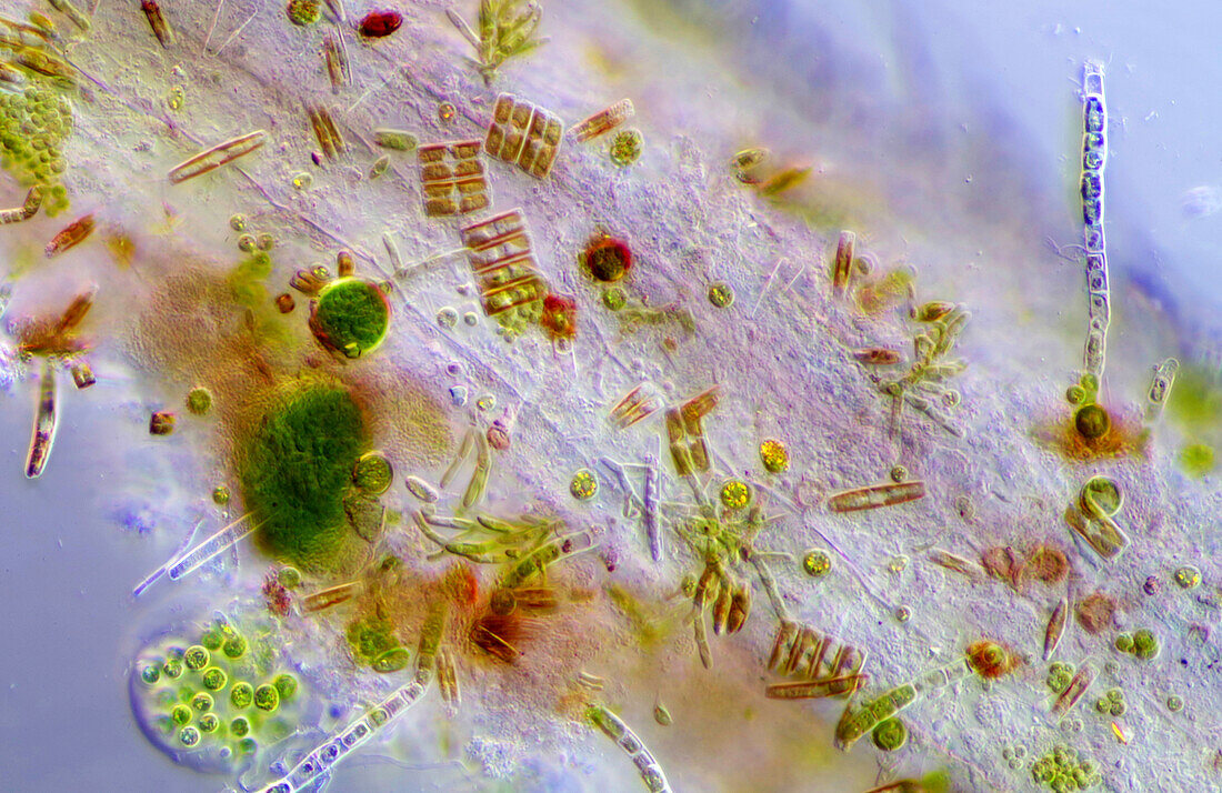 Microalgae settled on Lemna sp. root, light micrograph