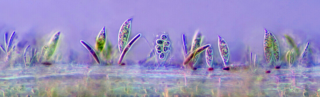 Microalgae settled on Lemna sp. root, light micrograph
