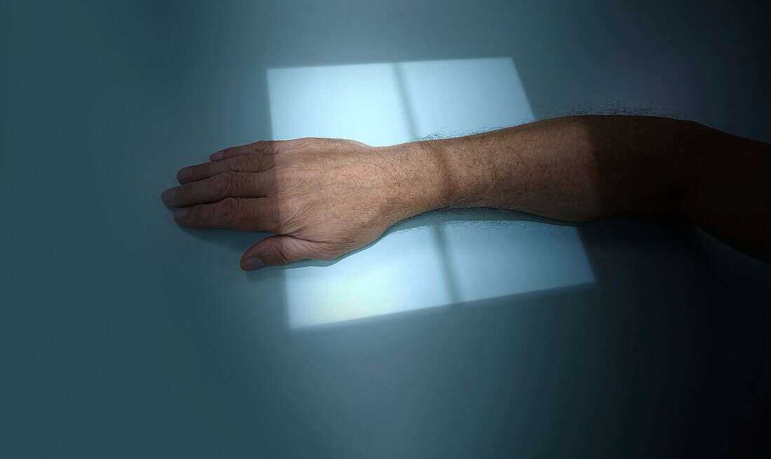 Wrist X-ray