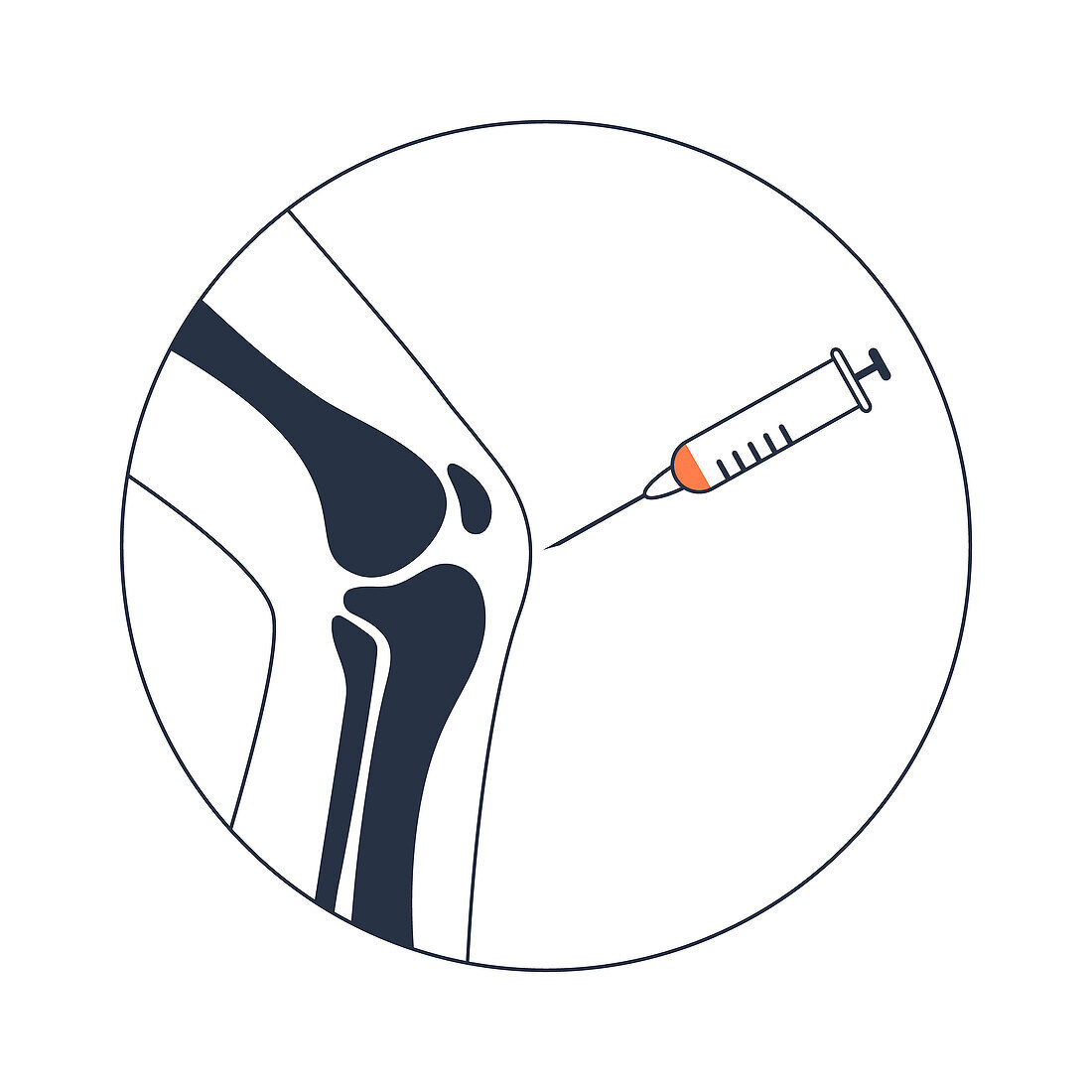 PRP knee treatment, conceptual illustration
