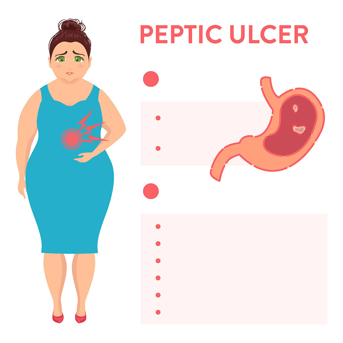 Peptic ulcer symptoms, illustration