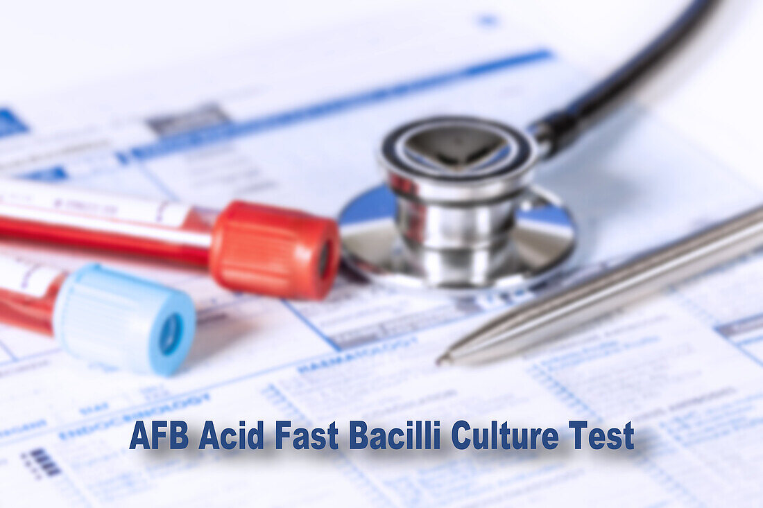 Acid fast bacilli culture test, conceptual image