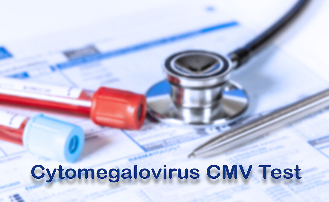 Cytomegalovirus test, conceptual image