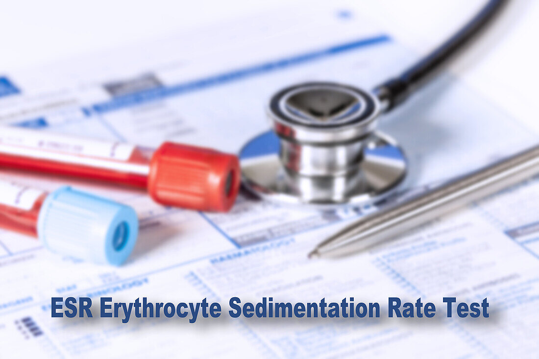 Erythrocyte sedimentation rate test, conceptual image